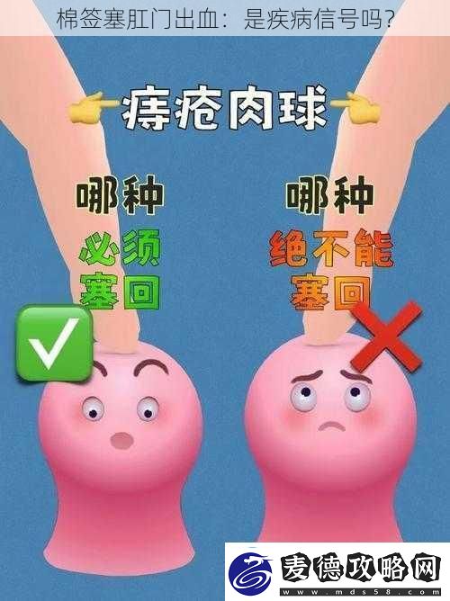 棉签塞肛门出血