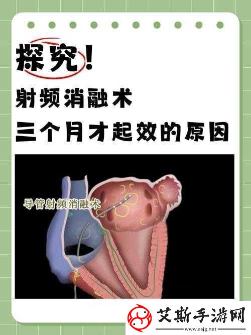 433MHz射频对人体有影响吗：探究其潜在危害与真相