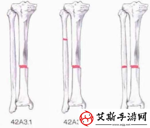 好想c1v3骨科：探讨隐秘而美丽的内心之声