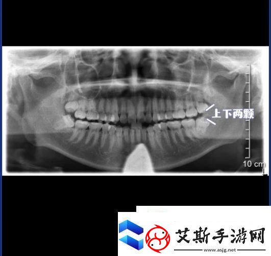 太粗大深好疼快拔出去的缓解方法：如何舒缓不适-提升体验麻生游戏攻略